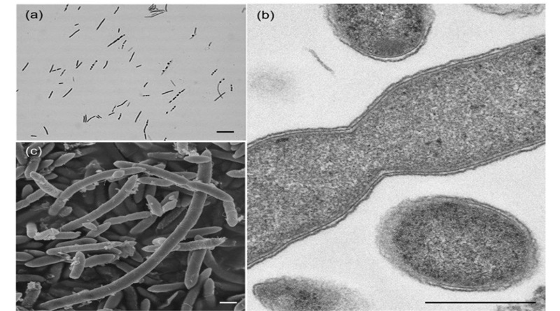 ¿Sabe qué le hace el café a su microbiota instetinal?