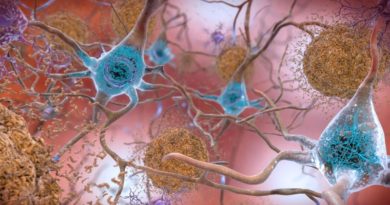 Retraso del sueño podría ser una señal temprana de Alzhéimer