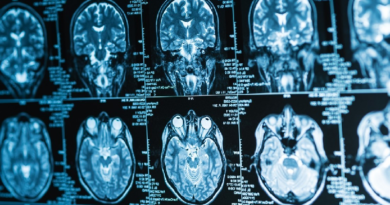 Crean implante cerebral que convierte pensamientos en palabras en tiempo real