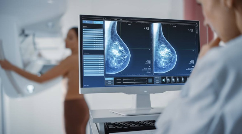 Dietas grasientas favorecen la metástasis del cáncer de mama