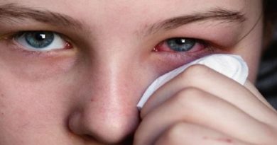 conozca-que-es-la-conjuntivitis