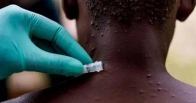 africa-registra-mas-muertes-colera-mpox-