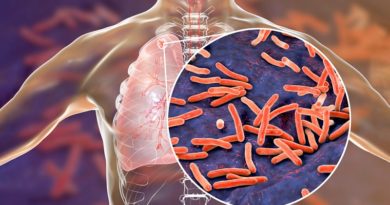 Científicos argentinos desarrollan test contra la tuberculosis