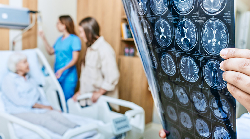 Descubren combinación de compuestos que limpian el cerebro de "proteínas alzhéimer"